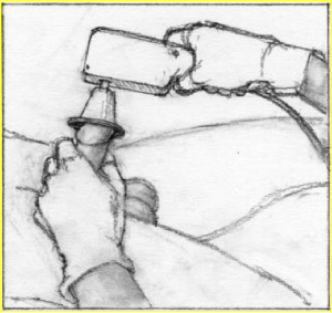 electroejaculation in the clinic spinal cord injury